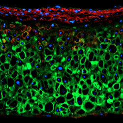 Descubren que un gen que regula el crecimiento del cart&iacute;lago podr&iacute;a dar lugar a terapias para reparar articulaciones