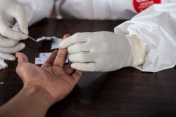 Francia registra otras 531 muertes en el &uacute;ltimo d&iacute;a ante un descenso de la cifra de pacientes en la UCI