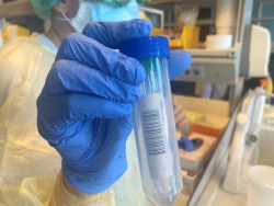 Las pruebas de rutina para COVID-19 pueden hacer que la cirug&iacute;a sea m&aacute;s segura, seg&uacute;n un estudio