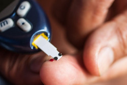 Los trasplantes de c&eacute;lulas madre de la m&eacute;dula &oacute;sea pueden beneficiar a algunos pacientes con diabetes de tipo 2