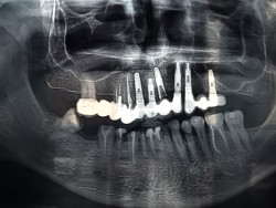 S&oacute;lo un metaverso suelto.Eduardo Madro&ntilde;al