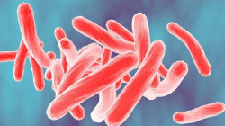 Un estudio relaciona la salud mental con el riesgo de tuberculosis
